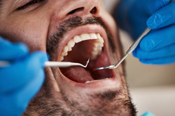 Best Emergency Treatment for Dental Infections or Abscesses in Englewood, CO